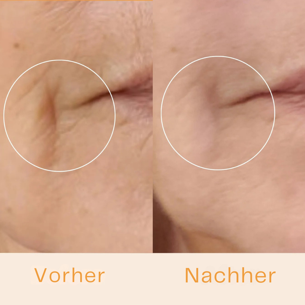 GlowLift - Dein Anti-Aging Stab für glatte Haut