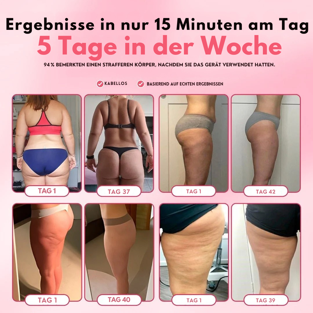 SkinGlow – Anti-Cellulite Massagegerät