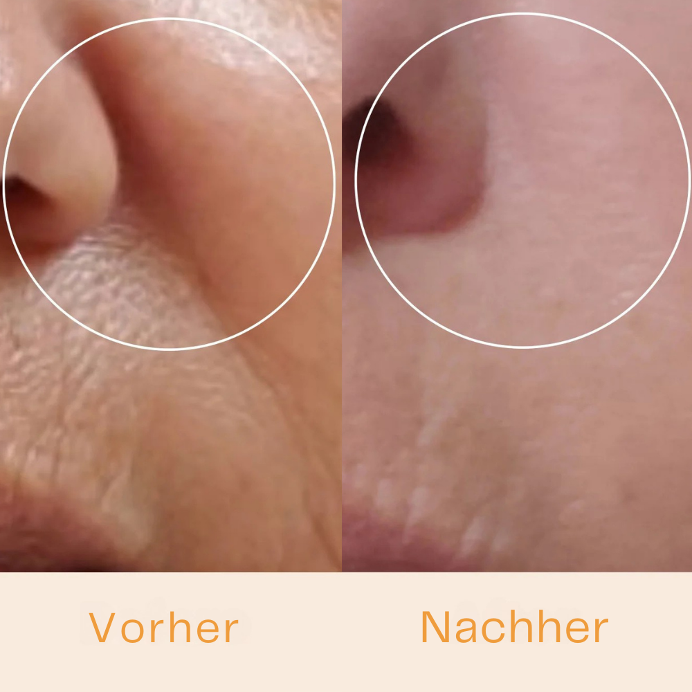 GlowLift - Dein Anti-Aging Stab für glatte Haut