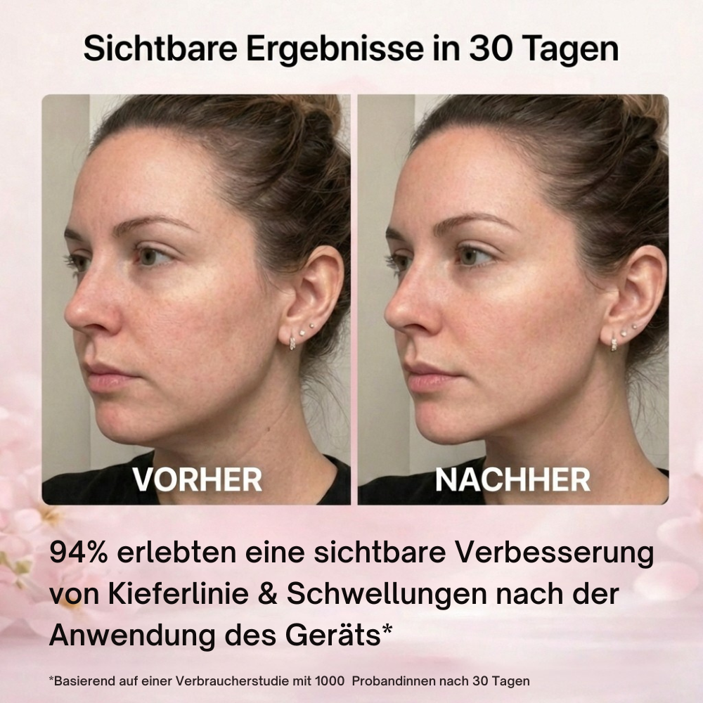 VELURA™ - EMS Face Lifting