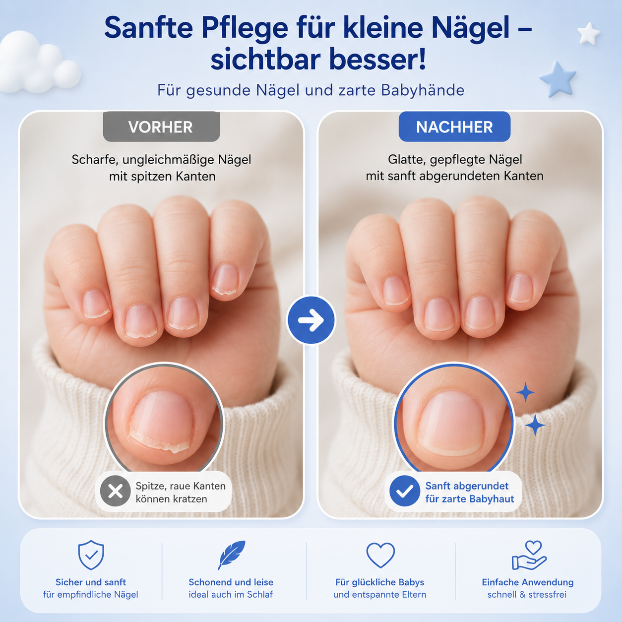 Calmy - Baby Nageltrimmer