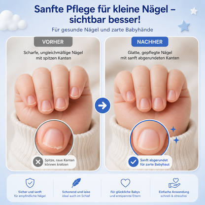 Calmy - Baby Nageltrimmer