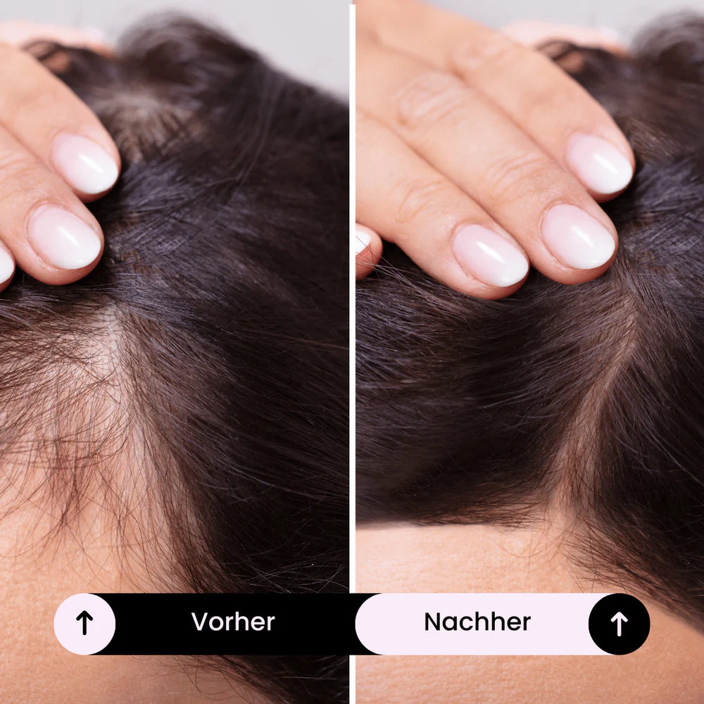 LUMIVA - Elektrisches Kopfhaut-Massagegerät