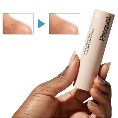 Pirequel™ Aknenarben-Stick