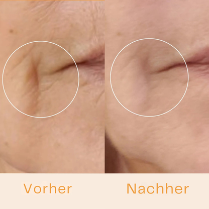 GlowLift - Dein Anti-Aging Stab für glatte Haut