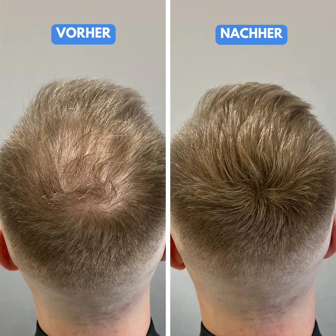 Sevich Magic Volume – Haarverdichtungsfasern