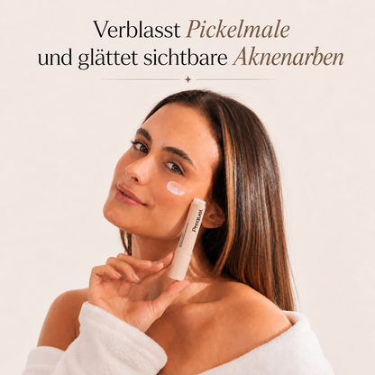 Prequel™ Aknenarben-Stick