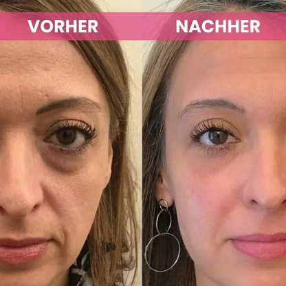 Glowpads – Augenpad mit Rotlicht & Mikrostrom