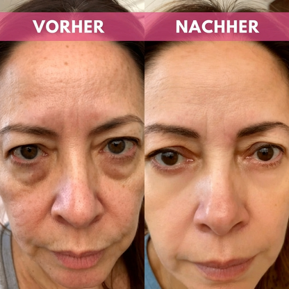 Glowpads – Augenpad mit Rotlicht & Mikrostrom